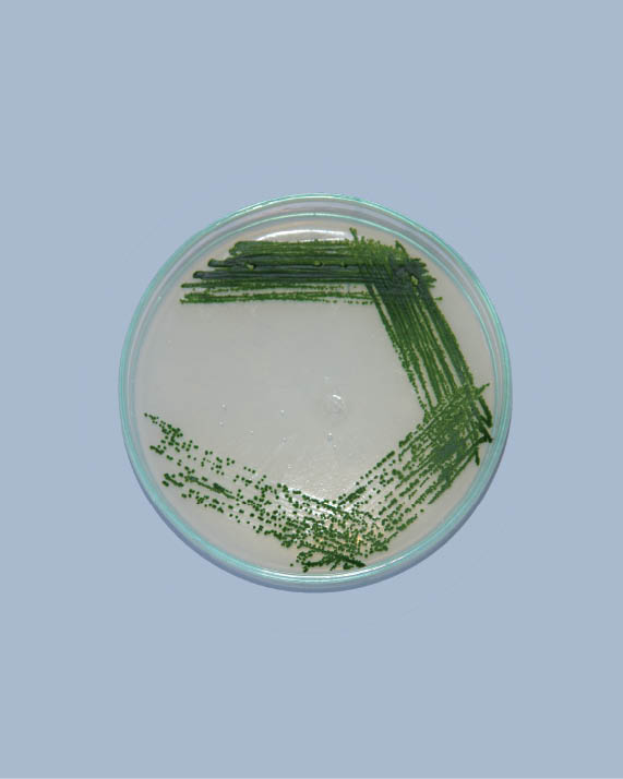 Renewable Green Fuel from Marine Microalgae